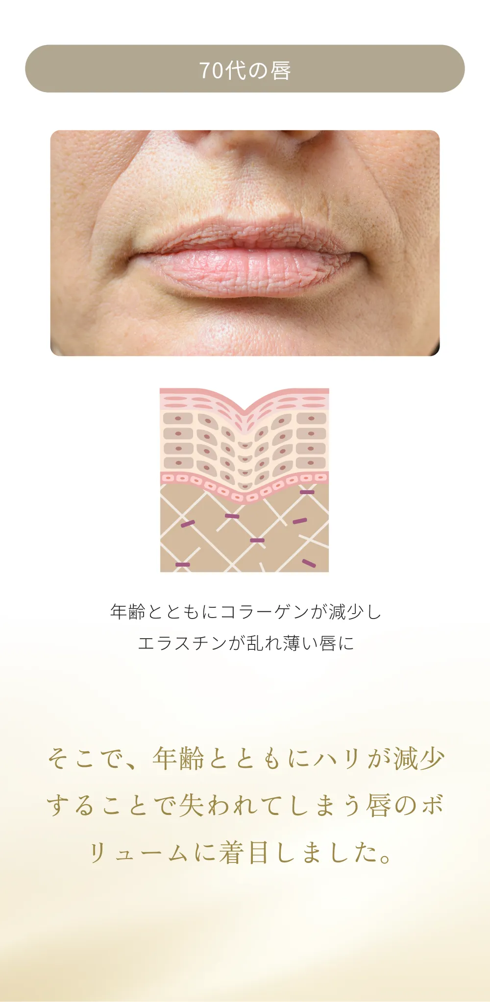 加齢によりハリが低下し、縦じわが目立つ唇の比較イメージ