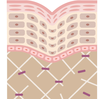 コラーゲンが減少した状態