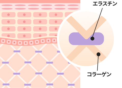 コラーゲン・エラスチンが整っている状態